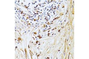 Immunohistochemistry (Paraffin-embedded Sections) (IHC (p)) image for anti-Transforming Growth Factor, beta-Induced, 68kDa (TGFBI) (AA 481-683) antibody (ABIN3023373)