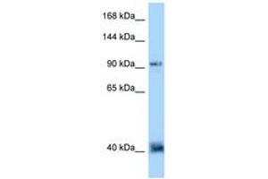 Image no. 1 for anti-Dapper, Antagonist of beta-Catenin, Homolog 1 (DACT1) (AA 139-188) antibody (ABIN6748062)