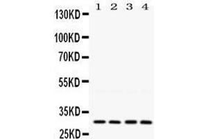 Western Blotting (WB) image for anti-Lysyl Oxidase (LOX) (AA 240-268), (Middle Region) antibody (ABIN3042506) (LOX 抗体  (Middle Region))