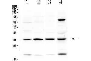 Western blot analysis of STUB1 using anti-STUB1 antibody . (STUB1 抗体  (AA 51-303))