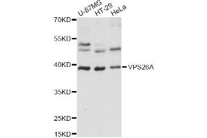 Western blot analysis of extracts of various cell lines, using VPS26A antibody (ABIN6292339) at 1:1000 dilution. (VPS26A 抗体)