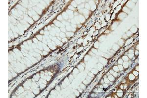 Immunoperoxidase of monoclonal antibody to SARS on formalin-fixed paraffin-embedded human colon tissue. (Seryl-tRNA Synthetase (SARS) (AA 1-514) 抗体)