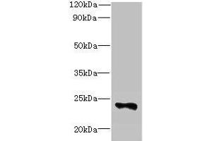 Western blot All lanes: FAM156A antibody at 5 μg/mL + Mouse heart tissue Secondary Goat polyclonal to rabbit IgG at 1/10000 dilution Predicted band size: 25 kDa Observed band size: 25 kDa (FAM156A 抗体  (AA 1-153))