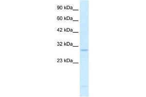 WB Suggested Anti-RALY Antibody Titration:  0.