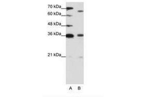 Image no. 1 for anti-PR Domain Containing 13 (PRDM13) (C-Term) antibody (ABIN202883) (PRDM13 抗体  (C-Term))