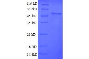 SDS-PAGE (SDS) image for Thymidine Kinase 1, Soluble (TK1) (AA 1-376), (full length) protein (His tag) (ABIN5710502) (TK1 Protein (AA 1-376, full length) (His tag))