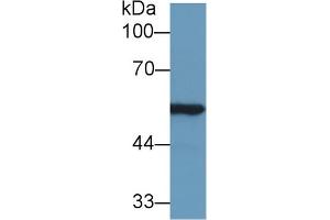 Western blot analysis of Rat Kidney lysate, using Mouse ALDH7A1 Antibody (1 µg/ml) and HRP-conjugated Goat Anti-Rabbit antibody (