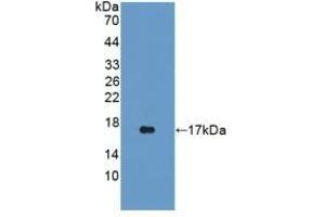 Detection of Recombinant iNV, Rat using Polyclonal Antibody to Involucrin (INV) (Involucrin 抗体  (AA 461-551))
