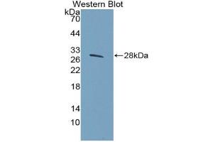 Detection of Recombinant HSPG2, Human using Polyclonal Antibody to Heparan Sulfate Proteoglycan 2 (HSPG2) (HSPG2 抗体  (AA 4149-4391))