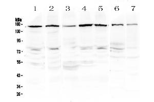 Western blot analysis of PER3 using anti-PER3 antibody . (PER3 抗体  (AA 1085-1199))