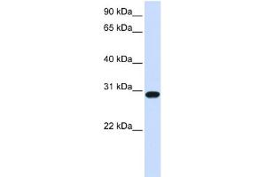 WB Suggested Anti-FOXR1 Antibody Titration:  0. (FOXR1 抗体  (N-Term))