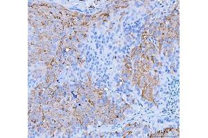 IHC analysis of Desmoglein 2/DSG2 using anti-Desmoglein 2/DSG2 antibody (ABIN7600804).