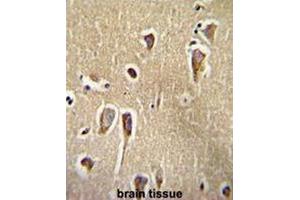 Immunohistochemistry (Paraffin-embedded Sections) (IHC (p)) image for anti-Corticotropin Releasing Hormone Receptor 2 (CRHR2) (AA 27-58) antibody (ABIN951704)