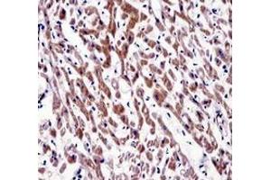 Immunohistochemistry analysis in human heart tissue (Formalin-fixed, Paraffin-embedded) using MOV10 Antibody (N-term), followed by peroxidase conjugated secondary antibody and DAB staining. (MOV10 抗体  (N-Term))