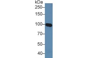Western Blot; Sample: Human Serum; Primary Ab: 5µg/ml Rabbit Anti-Human MAG Antibody Second Ab: 0. (MAG 抗体  (AA 328-514))