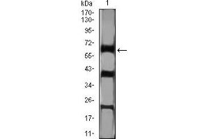 Western Blotting (WB) image for anti-Catenin, beta Like 1 (CTNNBL1) (AA 390-557) antibody (ABIN7193357)