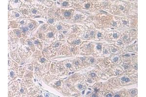 Detection of IL7R in Human Liver Tissue using Polyclonal Antibody to Interleukin 7 Receptor (IL7R)