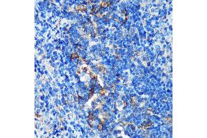Immunohistochemistry of paraffin-embedded Rat spleen using GMIP Rabbit pAb (ABIN7267369) at dilution of 1:100 (40x lens). (GMIP 抗体  (AA 1-91))