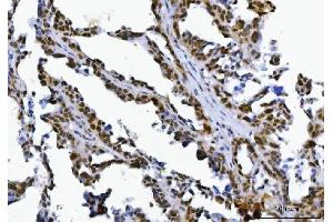 IHC analysis of SPT5/SUPT5H using anti-SPT5/SUPT5H antibody (ABIN7601985).