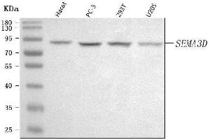 Western blot analysis of SEMA3D using anti-SEMA3D antibody (ABIN7602598).