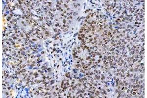 IHC analysis of HnRNP H/HNRNPH1 using anti-HnRNP H/HNRNPH1 antibody (ABIN4886623). (HNRNPH1 抗体  (N-Term))