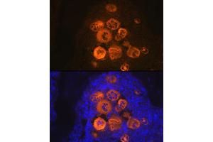 Immunofluorescence (IF) image for anti-Platelet Factor 4 (PF4) antibody (ABIN1683188)