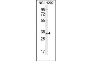 Western blot analysis using SFTPA2B Antibody (C-term) Cat. (SFTPA2 抗体  (C-Term))