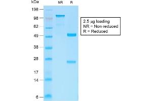 SDS-PAGE (SDS) image for anti-Catenin (Cadherin-Associated Protein), beta 1, 88kDa (CTNNB1) antibody (ABIN6939211)