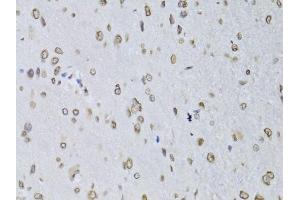 Immunohistochemistry of paraffin-embedded rat brain using LMNB2 Antibody (ABIN2563696) at dilution of 1:100 (40x lens). (Lamin B2 抗体)