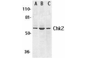 Western blot analysis of Chk2 expression in K562 (A), Jurkat (B), and HL-60 (C) whole cell lysates with AP30226PU-N Chk2 antibody at 1 μg /ml. (CHEK2 抗体  (N-Term))