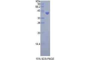 SDS-PAGE analysis of Pig FSHb Protein. (FSHB 蛋白)