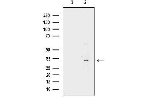 anti-Hydroxysteroid (17-Beta) Dehydrogenase 11 (HSD17B11) (Internal Region) antibody