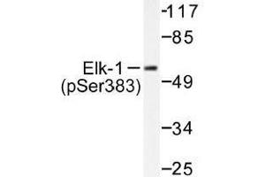 Image no. 1 for anti-ELK1, Member of ETS Oncogene Family (ELK1) (pSer383) antibody (ABIN318012) (ELK1 抗体  (pSer383))