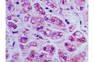 Image no. 1 for anti-Bone Marrow Stromal Cell Antigen 2 (BST2) (AA 80-130) antibody (ABIN960102) (BST2 抗体  (AA 80-130))