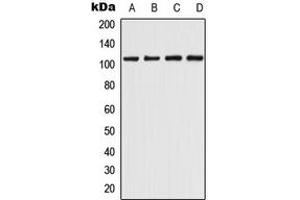 Western blot analysis of CHERP expression in THP1 (A), K562 (B), Raw264. (CHERP 抗体  (Center))