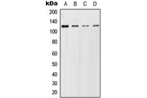 Western blot analysis of GCFC2 expression in HeLa (A), SP2/0 (B), PC12 (C) whole cell lysates. (GCFC2 抗体  (Center))
