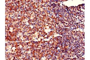 Immunohistochemistry (IHC) image for anti-Mitochondrial Ribosomal Protein L19 (MRPL19) (AA 1-292) antibody (ABIN7142365)