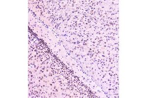 IHC analysis of Rad51 using anti-Rad51 antibody (ABIN6719396).