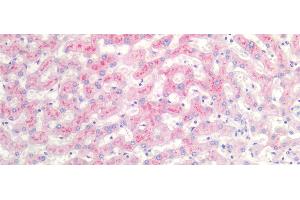 Detection of SAA in Human Liver Tissue using Monoclonal Antibody to Serum Amyloid A (SAA) (SAA 抗体  (AA 19-122))