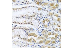 Immunohistochemistry of paraffin-embedded human stomach using TRMT1 antibody (ABIN5975089) at dilution of 1/100 (40x lens). (TRMT1 抗体)