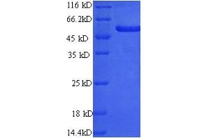 SDS-PAGE (SDS) image for Preferentially Expressed Antigen in Melanoma (PRAME) (AA 1-509), (full length) protein (His tag) (ABIN5710139) (PRAME Protein (AA 1-509, full length) (His tag))