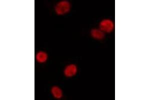 ABIN6275603 staining Hela by IF/ICC. (SF3B3 抗体  (C-Term))