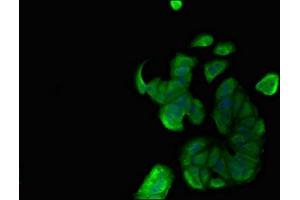 Immunofluorescent analysis of MCF-7 cells using ABIN7160462 at dilution of 1:100 and Alexa Fluor 488-congugated AffiniPure Goat Anti-Rabbit IgG(H+L) (MNDA 抗体  (AA 84-233))
