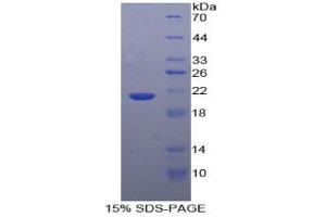 SDS-PAGE analysis of Human GaA Protein. (GAA 蛋白)