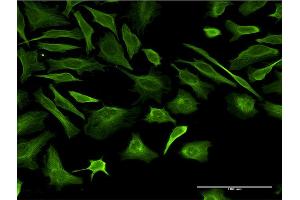 Immunofluorescence of monoclonal antibody to TUBB2A on HeLa cell. (TUBB2A 抗体  (AA 1-445))