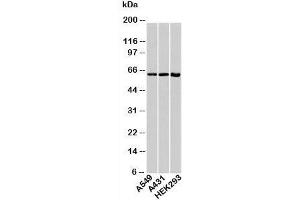 Western blot testing of human samples with HSP60 antibody at 1ug/ml. (HSPD1 抗体)