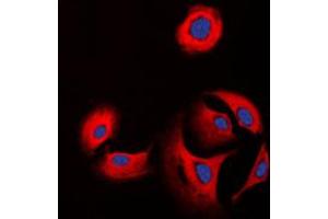 Immunofluorescence (IF) image for anti-Collagen, Type XI, alpha 1 (COL11A1) (Center) antibody (ABIN7295332)