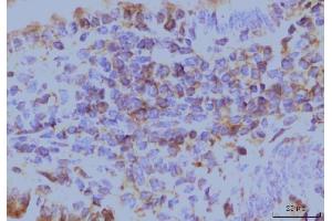 IHC analysis of EIF4A1 using anti-EIF4A1 antibody (ABIN7603144).