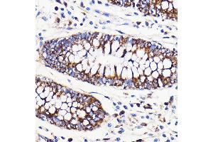 Immunohistochemistry (IHC) image for anti-Mitofusin 2 (MFN2) (AA 500-600) antibody (ABIN6143800)