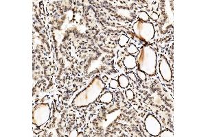 IHC analysis of SPHK1 using anti-SPHK1 antibody (ABIN7600168).
